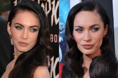 Megan-Fox-Plastic-Surgery-Pics-500x333.jpg